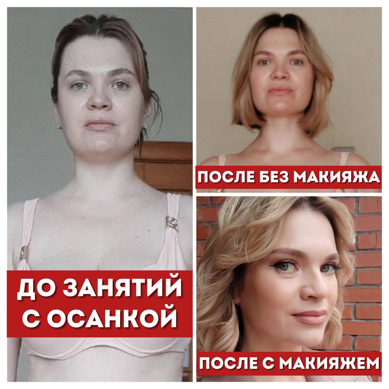 Статья «Сохранить лицо в климаксе?» 7 до после света