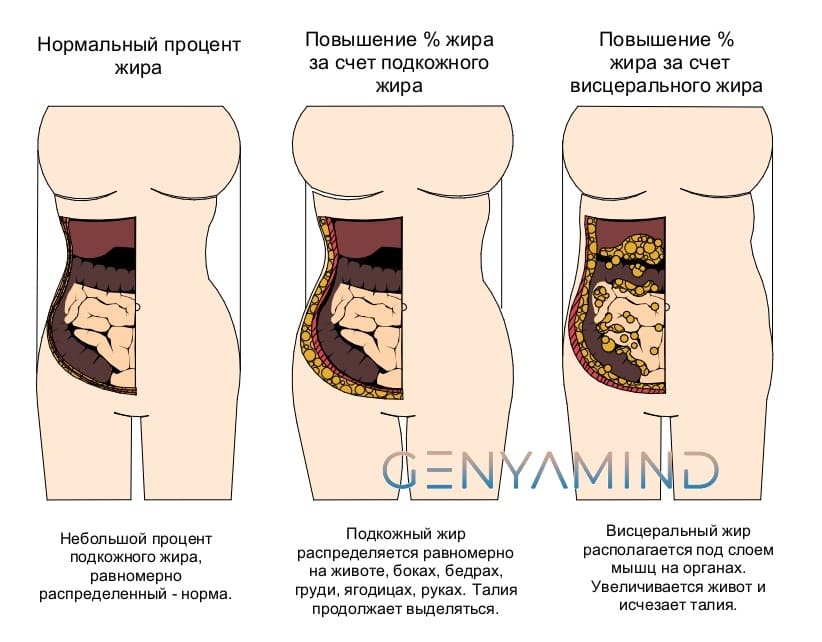 Висцеральный жир 1