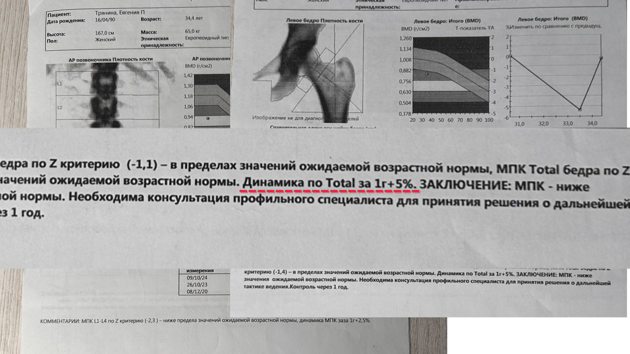 денситометрия